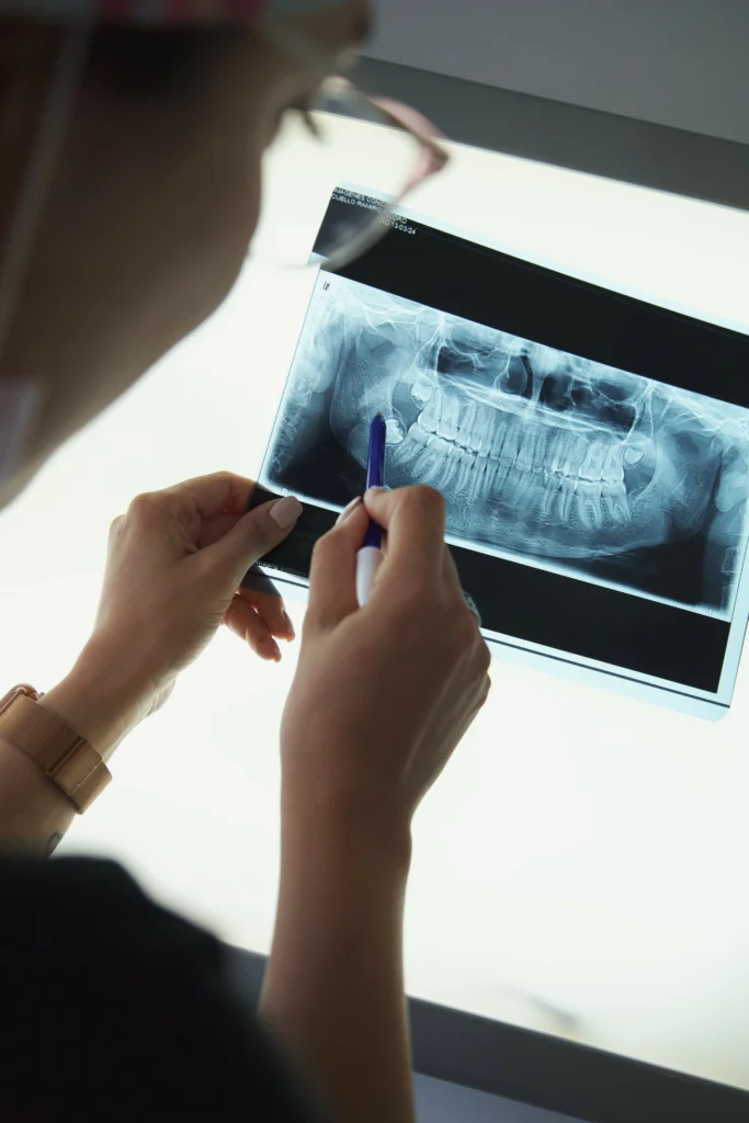 Tratamientos Odontológicos 3 lb odontolgía pilar tratamientos odontológicos dentista mirando placa radiologica